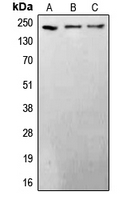 1 - Anti-BRCA1 Antibody AP51017