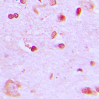 19 - Anti-BRCA1 Antibody AP51018