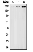 1 - Anti-BRCA1 Antibody AP51018