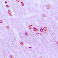 19 - Anti-BRD3 Antibody AP51019