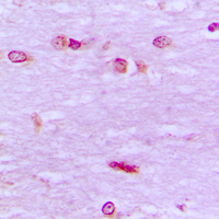 19 - Anti-BRF1 Antibody AP51020