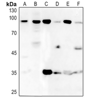 1 - Anti-BRF1 Antibody AP51020