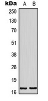 1 - Anti-BTF3L4 Antibody AP51022