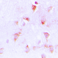 19 - Anti-C1QBP Antibody [KO/KD Validated] AP51024