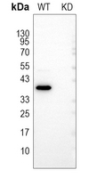 0 - Anti-C1QBP Antibody [KO/KD Validated] AP51024