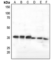 1 - Anti-C1QBP Antibody [KO/KD Validated] AP51024