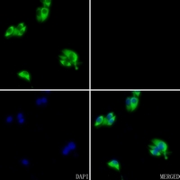 3 - Anti-Complement C1R LC Antibody AP51025