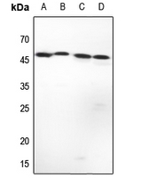 1 - Anti-Complement C1R LC Antibody AP51025