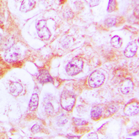 19 - Anti-Complement C6 Antibody AP51026