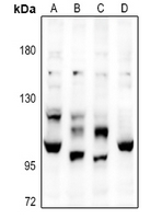 1 - Anti-Complement C6 Antibody AP51026