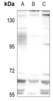1 - Anti-Complement C9 Antibody AP51027