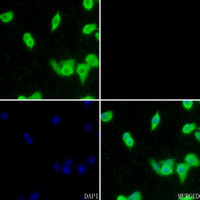 3 - Anti-Carbonic Anhydrase 1 Antibody AP51028