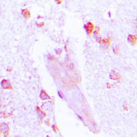 19 - Anti-Carbonic Anhydrase 1 Antibody AP51028