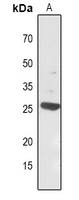 1 - Anti-Carbonic Anhydrase 1 Antibody AP51028