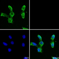 3 - Anti-Carbonic Anhydrase 5A Antibody AP51029