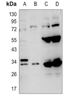 1 - Anti-Carbonic Anhydrase 5A Antibody AP51029