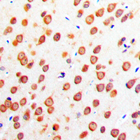 19 - Anti-CADM4 Antibody AP51030