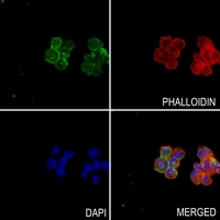 3 - Anti-Procalcitonin Antibody AP51031