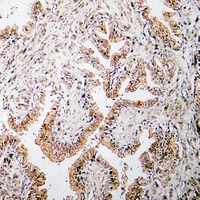 19 - Anti-Procalcitonin Antibody AP51031