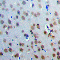 19 - Anti-CAMKV Antibody AP51032