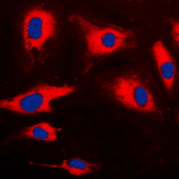 3 - Anti-CARD14 Antibody AP51033