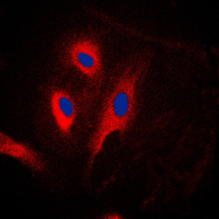 3 - Anti-CARD6 Antibody AP51034