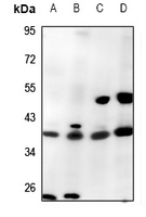 1 - Anti-Caspase 1 Antibody AP51035