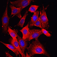 3 - Anti-Caspase 1 Antibody AP51036