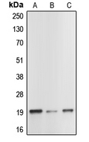 1 - Anti-Caspase 1 p20 Antibody AP51037