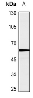 1 - Anti-Caspase 10 Antibody AP51039