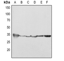 1 - Anti-Cleaved Caspase 2 Antibody AP51040