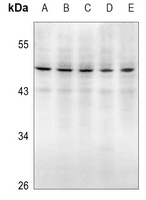 1 - Anti-Caspase 2 p18 Antibody AP51041