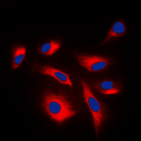 3 - Anti-Caspase 6 p18 Antibody AP51045