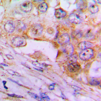 19 - Anti-Caspase 6 p18 Antibody AP51045