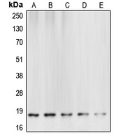 1 - Anti-Caspase 6 p18 Antibody AP51045