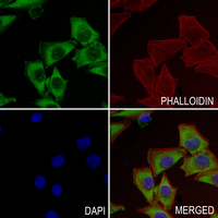 3 - Anti-Caspase 6 Antibody AP51046