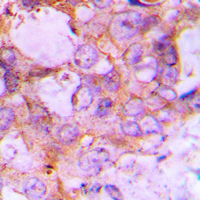 19 - Anti-Caspase 6 Antibody AP51046