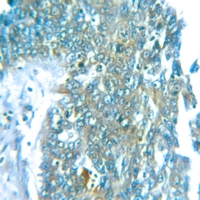 19 - Anti-Cerebellin 2 Antibody AP51047