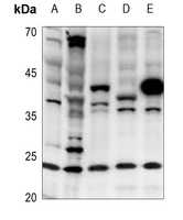 1 - Anti-Cerebellin 2 Antibody AP51047