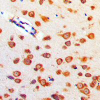 19 - Anti-Cerebellin 4 Antibody AP51048