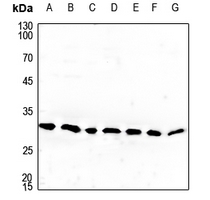 1 - Anti-Cerebellin 4 Antibody AP51048