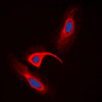 3 - Anti-CBR1 Antibody AP51049
