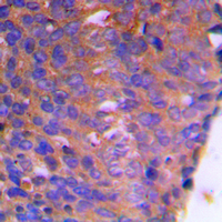 19 - Anti-CBR1 Antibody AP51049
