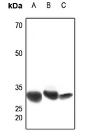 1 - Anti-CBR1 Antibody AP51049