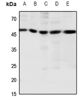 1 - Anti-CCKBR Antibody AP51051