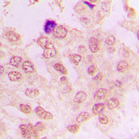 19 - Anti-Cyclin A1/2 Antibody AP51052