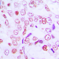 19 - Anti-Cyclin G1 Antibody AP51054