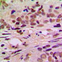 19 - Anti-Cyclin L1 Antibody AP51055