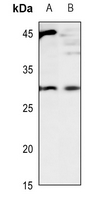 1 - Anti-CD70 Antibody AP51058
