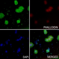3 - Anti-MRCK alpha Antibody AP51062